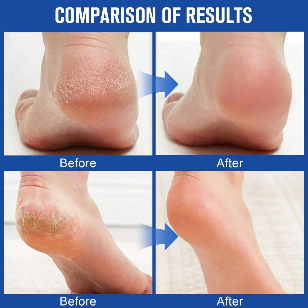 Loomi Silk-Axis™ Hand + Foot Care Stick
